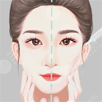 注射瘦脸价格