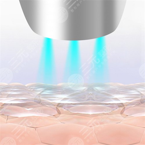 丽珠兰注射补水注意事项