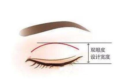 [超全]双眼皮6 7 8毫米果图，割多宽才更好看？