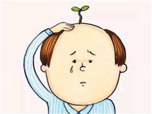 植发2000单位果图