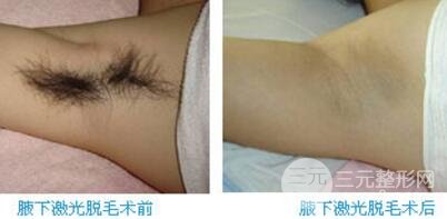 狐臭能被治愈吗?狐臭喜欢的治疗方法？狐臭手术后会不会留疤痕?