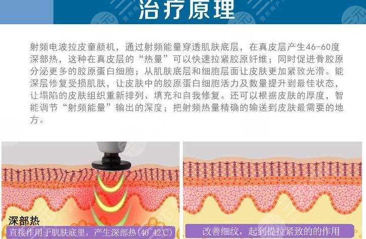 在线吃瓜网友科普：背上拉皮有什么好处和注意事项