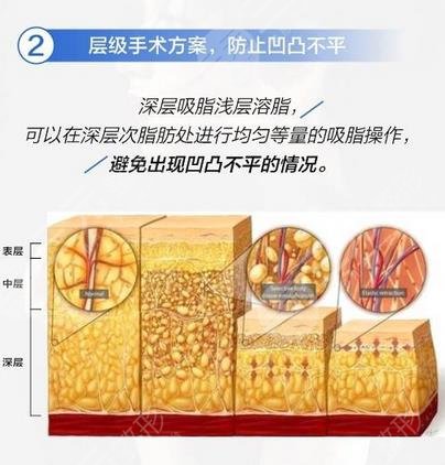 5g天使光雕