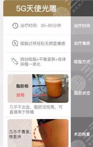 5g天使光雕吸脂术价格