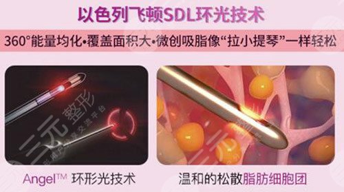 5g天使光雕吸脂术价格
