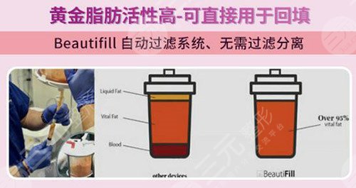 5g天使光雕吸脂术价格