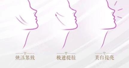赛诺龙5gmax的优势