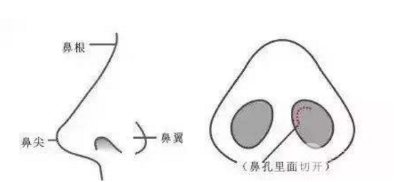 塌鼻子想要变美?教你一招怎样垫高鼻梁!-城市惠