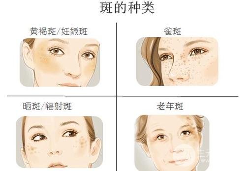 华西医院激光祛斑价格多少？术前术后注意事项汇总~
