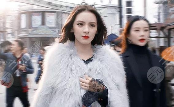 张予曦是不是整容