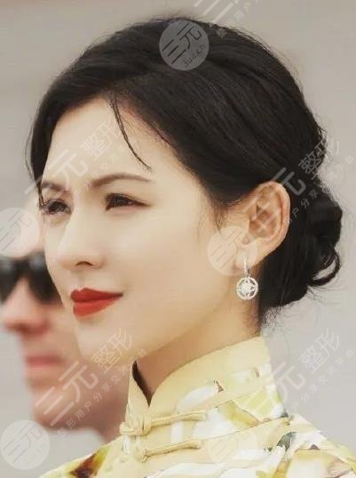 张予曦是不是整容