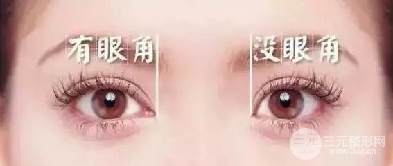 开眼角需要多少钱 适合人群较为广泛~