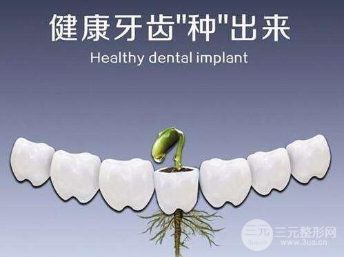 种植牙能用多久？使用寿命是多长？