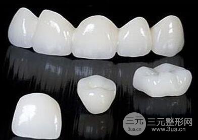 北京非贵金属烤瓷牙价格是多少