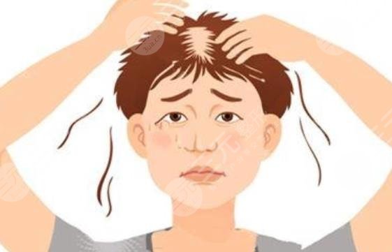 深圳人民医院植发需要多少钱