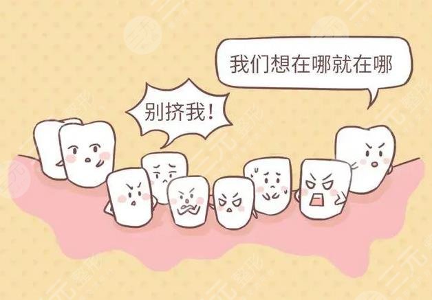 龙岗中心医院口腔科种植案例分享