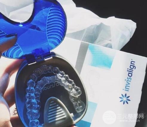 牙齿矫正案例