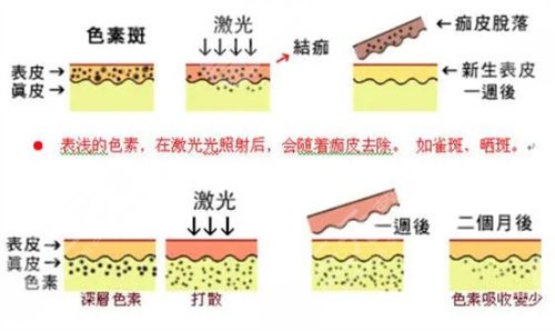北京安加医疗美容机构案例2：