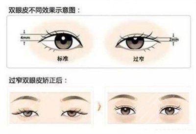 北京友谊医院美容科价格