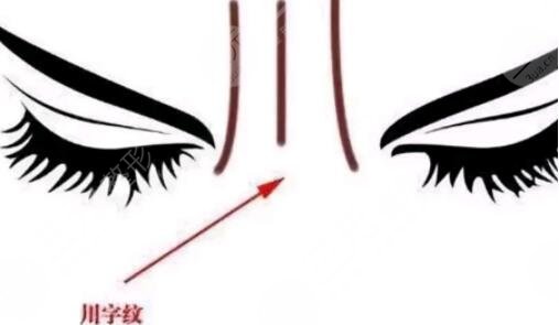 日常生活中的去皱小妙招