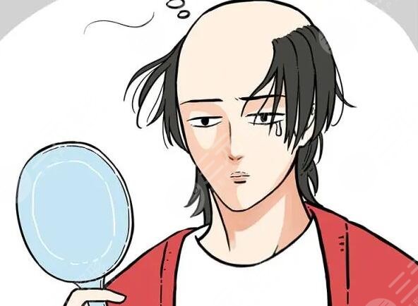 男人秃顶如何进行改善?