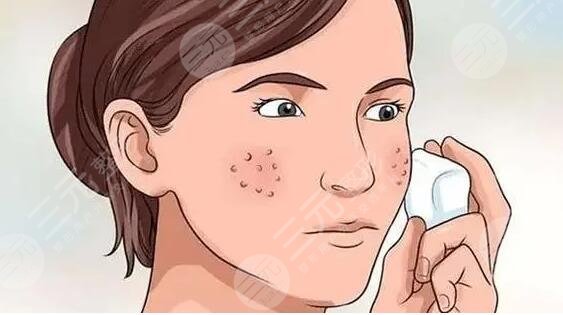 毛孔粗用什么护肤品,如果毛孔比较粗大的话可能会影响到整个人的皮肤美观度,而且对自己的气质可能会产生一定的影响,因此很多的人都想要选择更加适合自己的护肤品,进行一定的改善。而且很多的护肤品牌都能够改善毛孔粗大的现象,包括资生堂品牌的以及其他品牌的,都能够让整个人的皮肤状态看上去更加的光滑和细腻,改善毛孔粗大的现象。那么,毛孔粗用什么护肤品如何?    毛孔粗用什么护肤品?    毛孔粗,其实可以使用资生堂品牌的产品或者是科颜氏的产品,也可以选择SK II产品或珀莱雅产品等等,都能够达到收缩毛孔的效果,从而让整个人的毛孔看上去更加的细小。    1、资生堂/Shiseido。医院成立于1872年,而且目前是属于日本护肤品牌,并且在抗衰老方面做得很不错,也成为了美白行业中的先驱者,能够为大多数的顾客提供更加优质的服务和治疗。致力为不同复制提供专业的护理产品,而且也能够更好的收缩毛孔和对皮肤进行一定的调整,如今已经是享誉的美妆品牌,能够让肌肤状态看上去更加的年轻和自然。    2、HomeFacialPro。其实该产品主打成分护肤的品牌,而且也能够让整个人的皮肤看上去更加的光滑,能够达到收缩毛孔的作用。该产品以简单有效的理念研发更加优质的护肤产品,并且,产品有原液、面膜、洁面卸妆,而且还添加了一些水乳面霜、精华等,这些成分都是相对优质的产品。不仅能够让肌肤锁住水分,从而也能够让肌肤更加的白皙和透亮,添加了一些烟酰胺原液和玻尿酸原液,能够让肌肤状态更加的自然。    3、科颜氏/Kiehl's。其实该品牌的成立时间是1851年,而且属于较为优质的护肤品牌,秉持着环保和理念的治疗方案,而且采用了天然的成分,结合了前沿的科技技术,满足了爱美人士对皮肤美容方面的需求。而且,能够更好的收缩毛孔,从而让皮肤状态看上去更加的自然。    4、SK - II。该产品属于一种较为高端的护肤品牌,而且拥有着精华露等等也被称作神仙水,因此畅销量是相对较好的,主打的就是爽肤水,而且还有面霜等方面的产品。使用了之后不仅能够帮助肌肤锁住水分,同时也能够让整个人的毛孔得到更好的改善,改善了毛孔粗大的现象。    5、珀莱雅/PROYA。品牌的成立时间是2006年,而且里面添加了一些化妆水和面霜,并且也有面膜等等产品在使用了之后肌肤会更加的白皙,能够达到锁住水分的作用和目的。    6、悦木之源/Origins。该治疗拥有着更加天然的护肤理念,并且添加的一些成分,都是相对自然的植物成分。而且该产品的历史也是相对悠久的,同时也能够收缩毛孔,让肌肤更加的光滑和细腻。    7、雅诗兰黛。产品其实是很不错的,不仅在护肤品方面做的较好,也在化妆品和香水方面做得较好,具体的成立时间是1946年。而且为大多都是消费者提供了更加优质的医学产品,主要是面霜和美白原液能够淡化细纹,同时也能够收缩毛孔,让毛孔看上去更加的小。