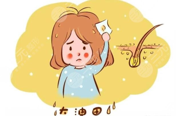 头发出油严重怎么解决?