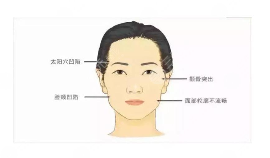 心形脸