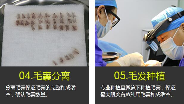 武汉,武总植发,专科,门诊,特惠,价格表,来啦