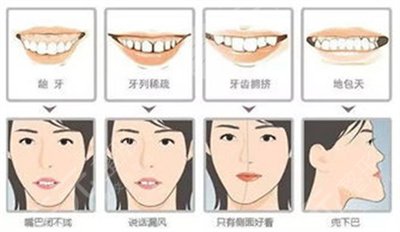 牙博士口腔医院怎么样？价格表一览/牙齿矫正案例分享~