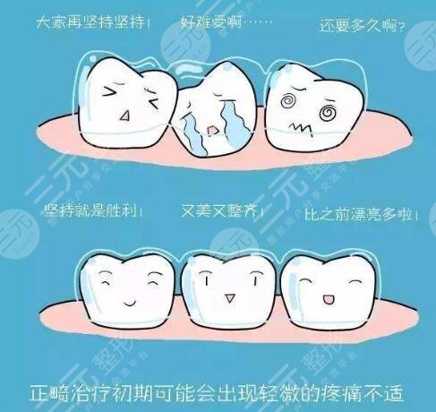 广州人民医院牙科正畸案例