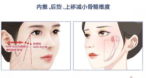 颧骨高的女人有什么不好？这面相真的“克夫”吗？