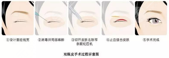 北京艺星整形医院擅长项目介绍