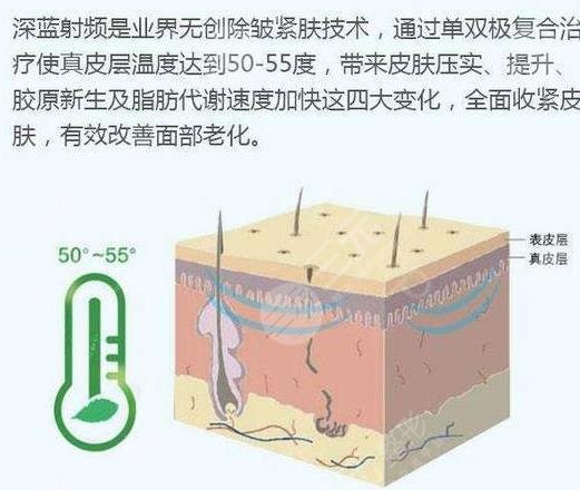 除皱美容手术的价格是多少?