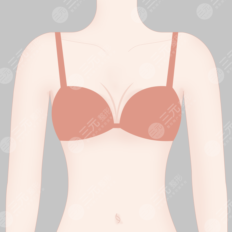 广州军美医疗美容医院吸脂术前