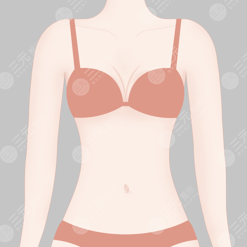 广州军美医疗美容医院吸脂术后果