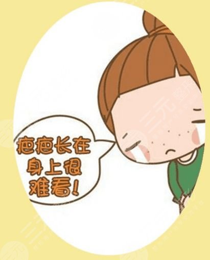 激光祛疤后多久能恢复