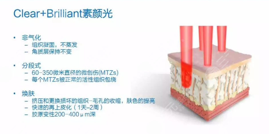 c+b素颜光和光子嫩肤的区别