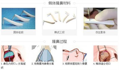 戴传昌专家鼻修复案例
