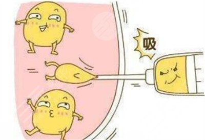 2025年杭州整形医生的排名榜，内附价格表和大腿吸脂案例~