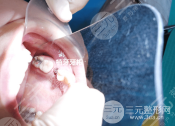 深圳同步齿科可以用医保吗