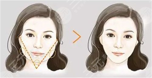 北京愉悦医疗美容医院靠谱吗？价格表&医生名单&整形案例~