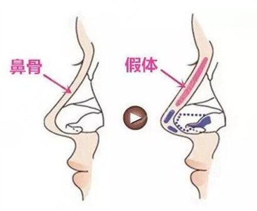 上海千美医疗美容院正规吗？医生实力&价格表&眼鼻整形案例~