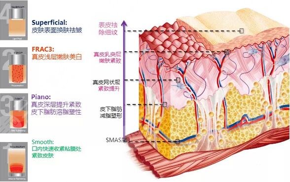 Fotona 4D将抗衰过程分为四大模式