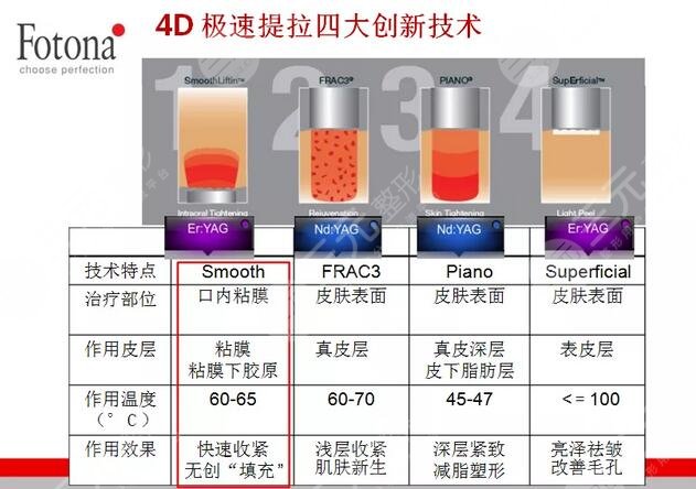 Fotona 4D将抗衰过程分为四大模式