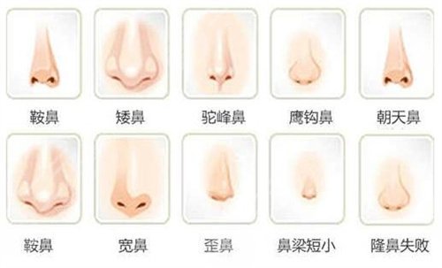 国服第(一)刀妹整容像经超?跟随自己擅长的英雄一起变化