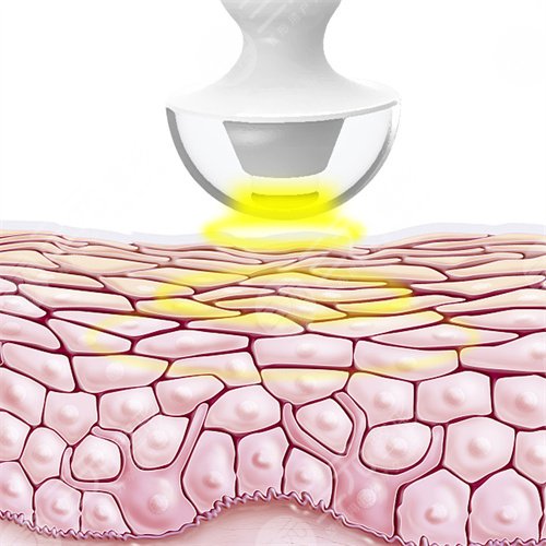 又整容又蹭热度?蔡徐坤颜值圈粉却矢口否认整容？