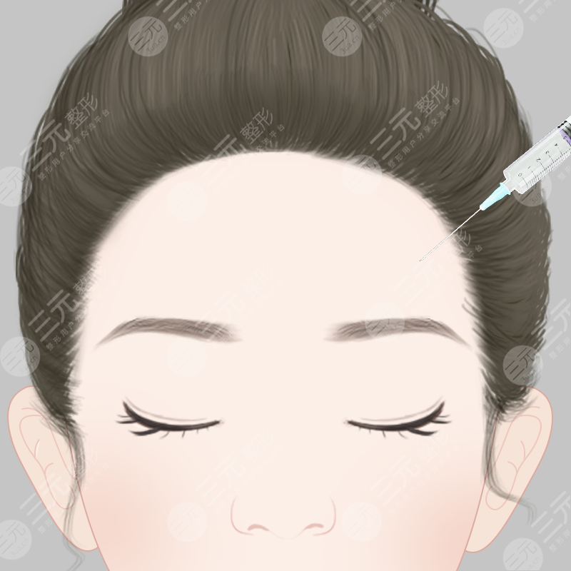 By2整容了吗？