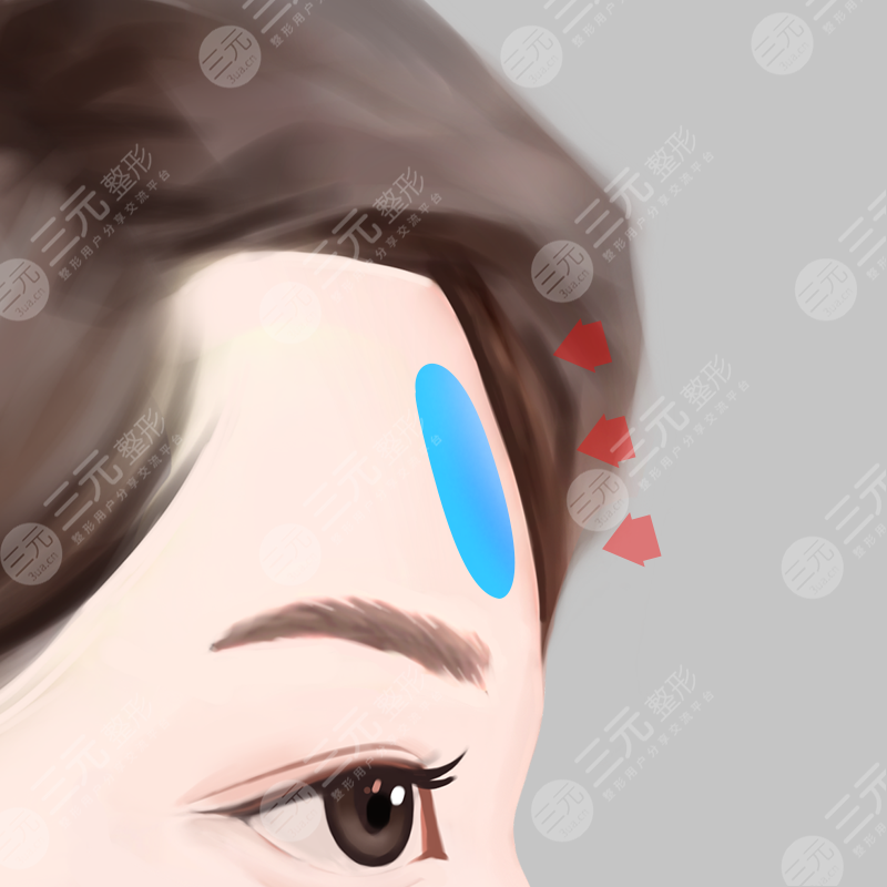 明星整容