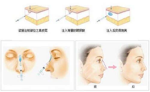 萨顶顶原名居然叫周鹏？萨顶顶整容前照片图片曝光，速来围观！